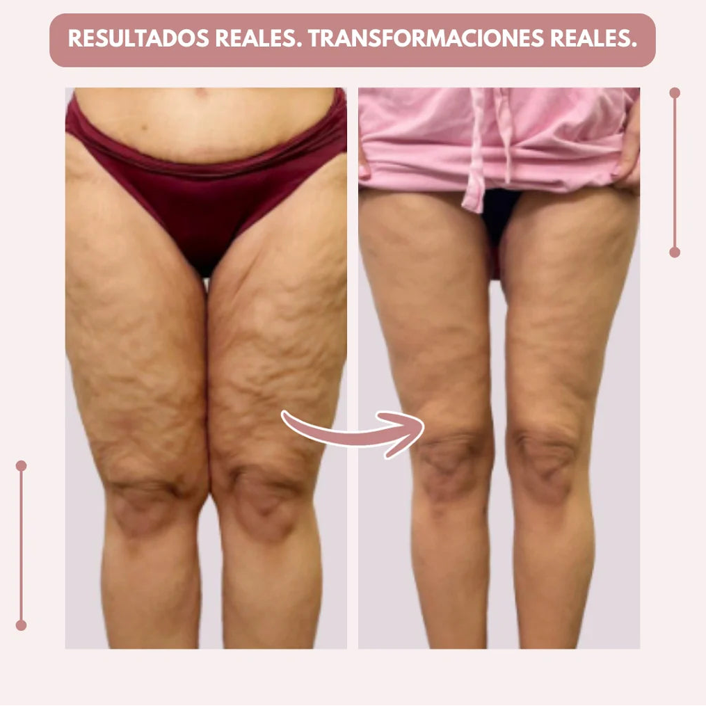 Calvrex Leggings 3D efecto moldeador